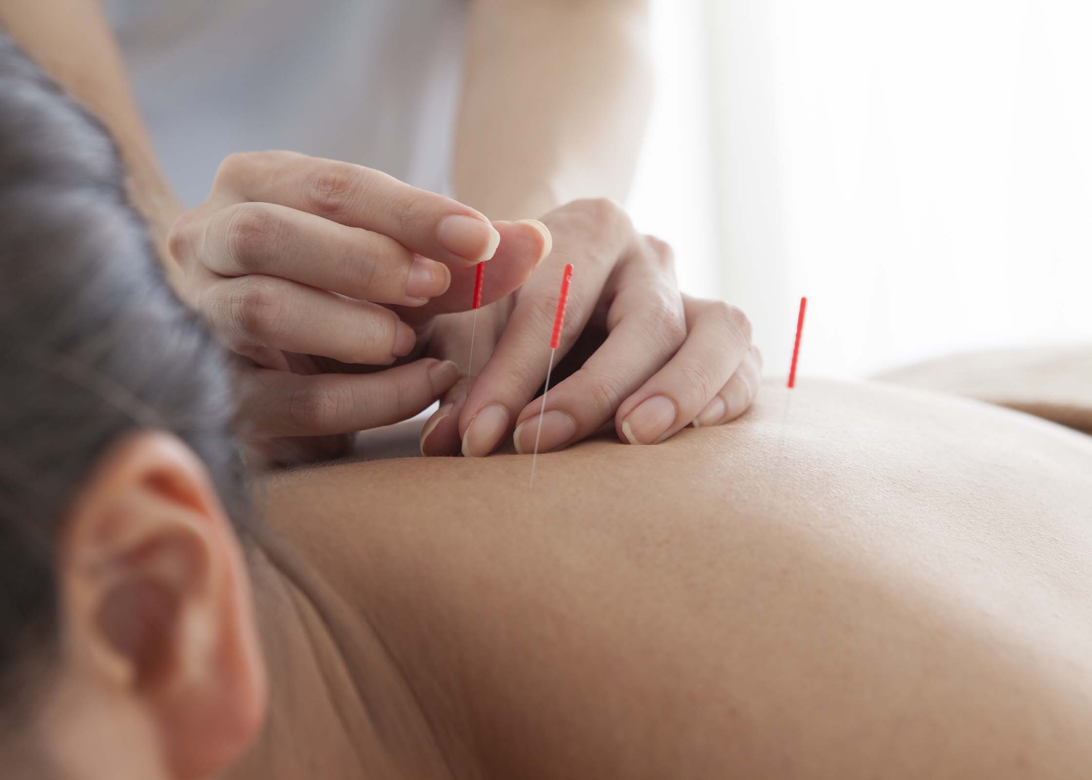 Move Well Acupuncture Move Well Acupuncture Fernie and Calgary